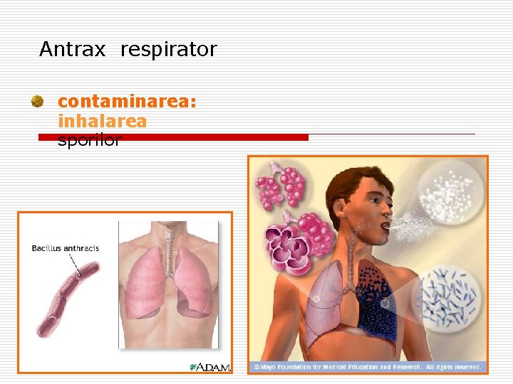 Antrax respirator contaminarea: inhalarea sporilor 