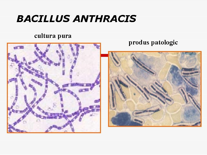  BACILLUS ANTHRACIS cultura produs patologic 