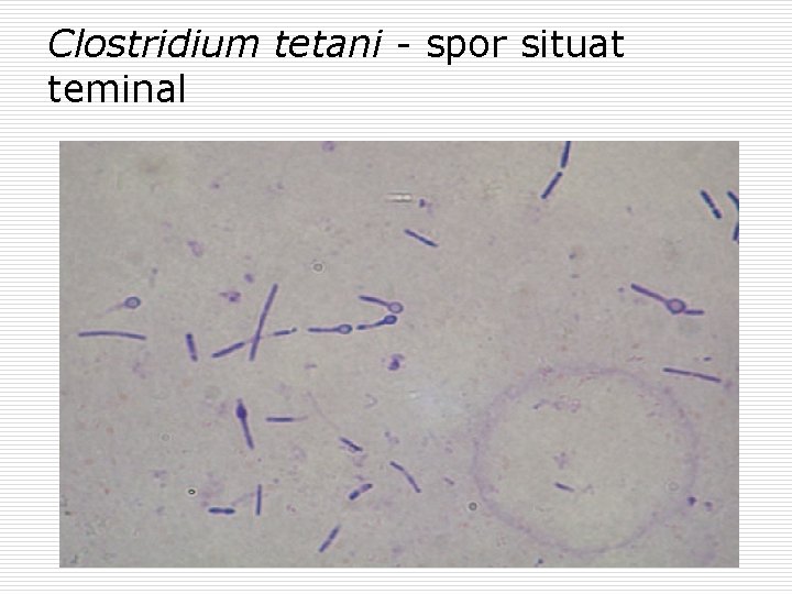 Clostridium tetani - spor situat teminal 