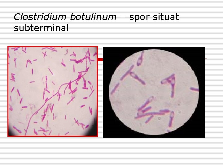 Clostridium botulinum – spor situat subterminal 