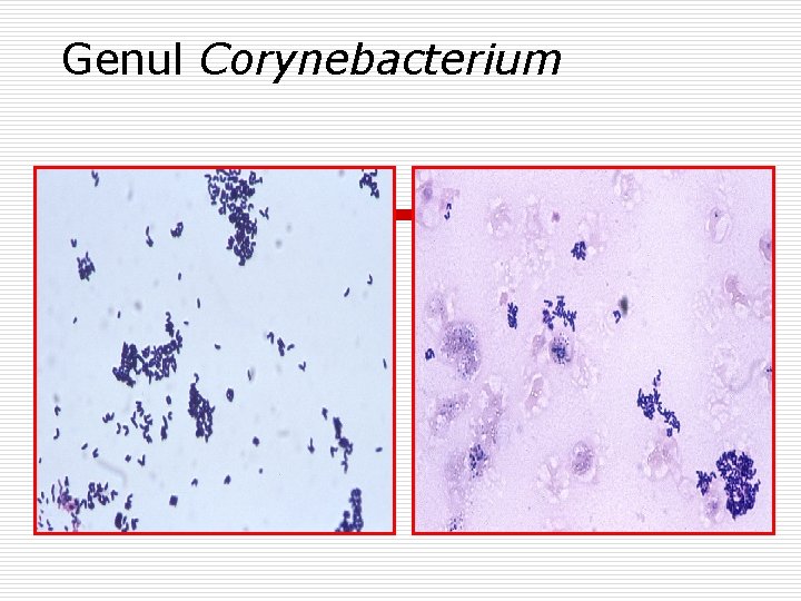 Genul Corynebacterium 