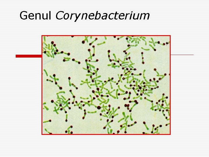 Genul Corynebacterium 
