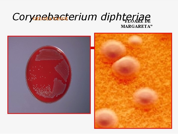 GELOZA SANGE Corynebacterium diphteriae “FLOARE DE MARGARETA” 