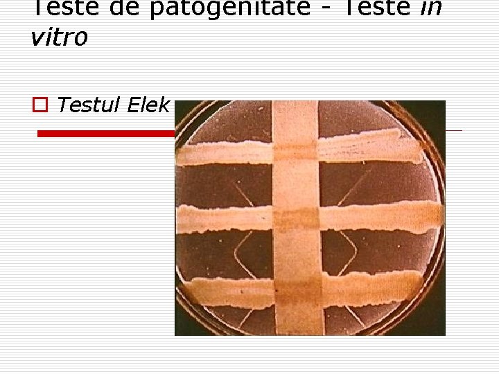 Teste de patogenitate - Teste in vitro o Testul Elek 