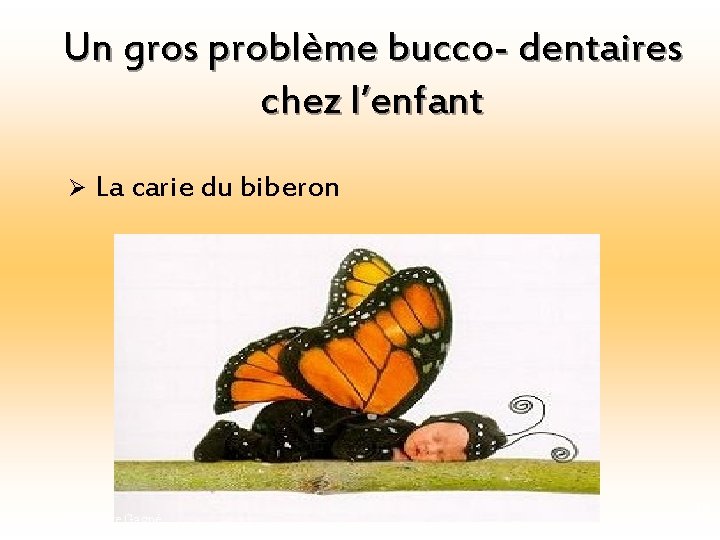 Un gros problème bucco- dentaires chez l’enfant Ø La carie du biberon Geneviève Gagné