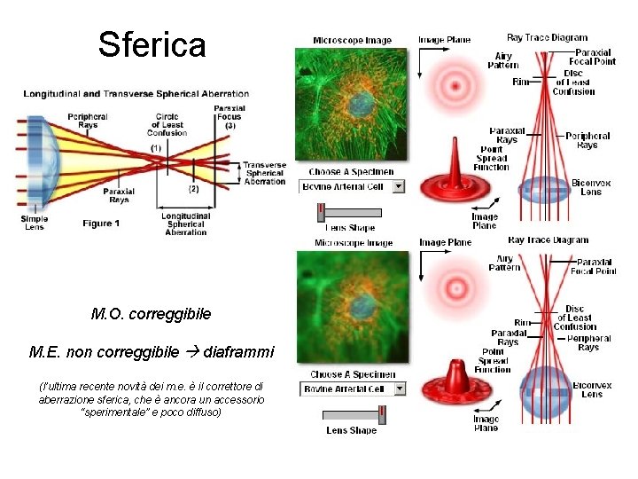 Sferica M. O. correggibile M. E. non correggibile diaframmi (l’ultima recente novità dei m.