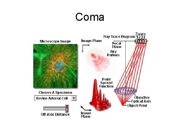 Coma 
