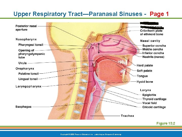 Upper Respiratory Tract—Paranasal Sinuses - Page 1 Figure 13. 2 Copyright © 2009 Pearson