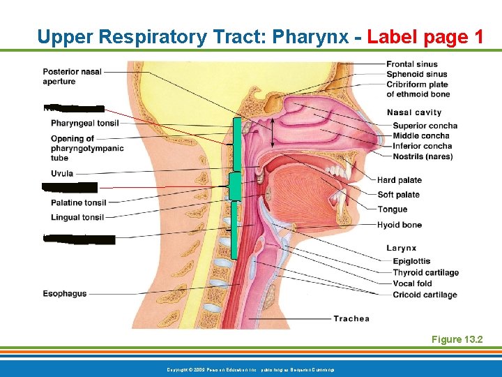 Upper Respiratory Tract: Pharynx - Label page 1 Figure 13. 2 Copyright © 2009