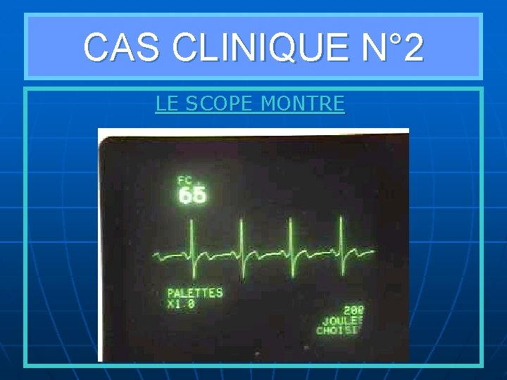 CAS CLINIQUE N° 2 LE SCOPE MONTRE 