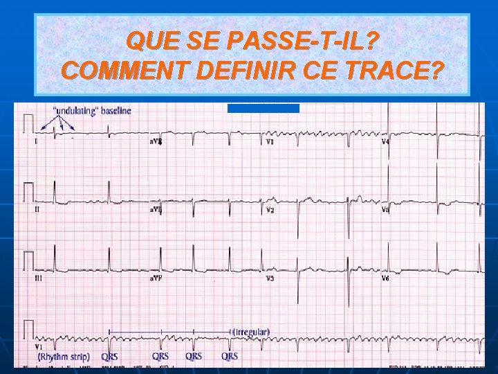 QUE SE PASSE-T-IL? COMMENT DEFINIR CE TRACE? 