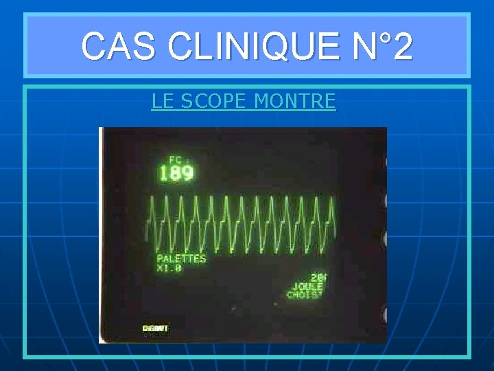 CAS CLINIQUE N° 2 LE SCOPE MONTRE 