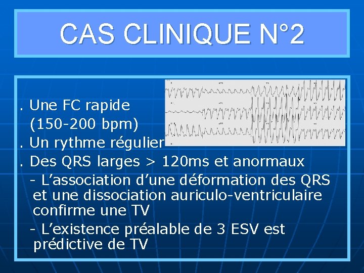CAS CLINIQUE N° 2. Une FC rapide (150 -200 bpm). Un rythme régulier. Des