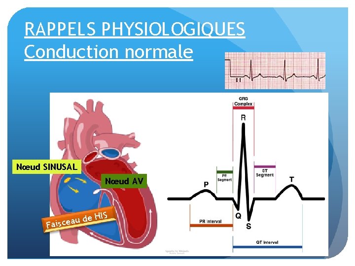 RAPPELS PHYSIOLOGIQUES Conduction normale Nœud SINUSAL Nœud AV de H u a e c