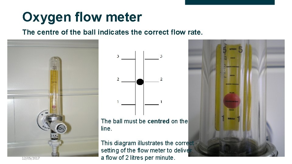 Oxygen flow meter The centre of the ball indicates the correct flow rate. The