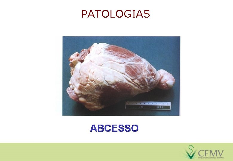 PATOLOGIAS 