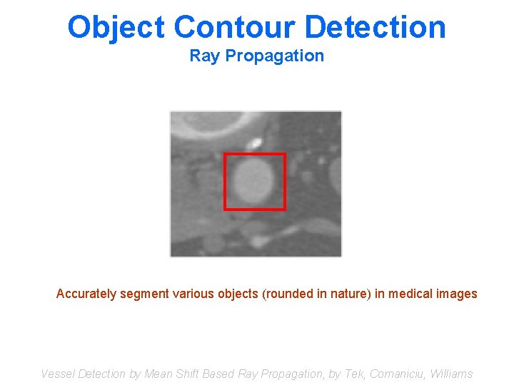 Object Contour Detection Ray Propagation Accurately segment various objects (rounded in nature) in medical