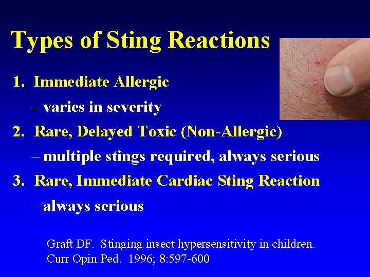Types of Sting Reactions 1. Immediate Allergic – varies in severity 2. Rare, Delayed