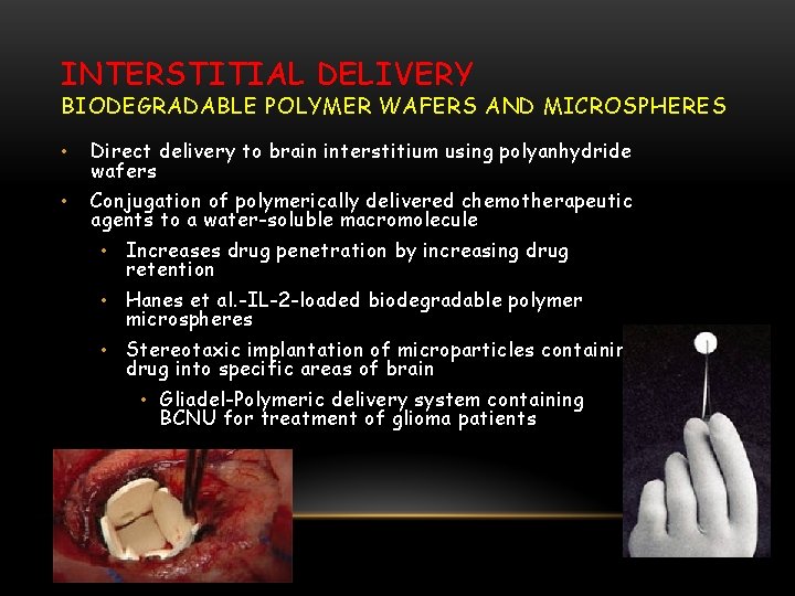 INTERSTITIAL DELIVERY BIODEGRADABLE POLYMER WAFERS AND MICROSPHERES • Direct delivery to brain interstitium using