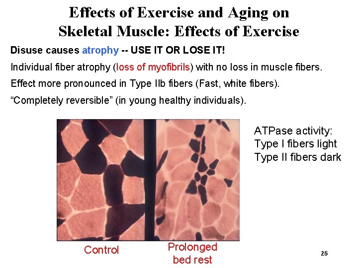 Effects of Exercise and Aging on Skeletal Muscle: Effects of Exercise Disuse causes atrophy