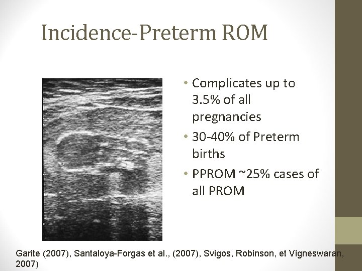 Incidence-Preterm ROM • Complicates up to 3. 5% of all pregnancies • 30 -40%