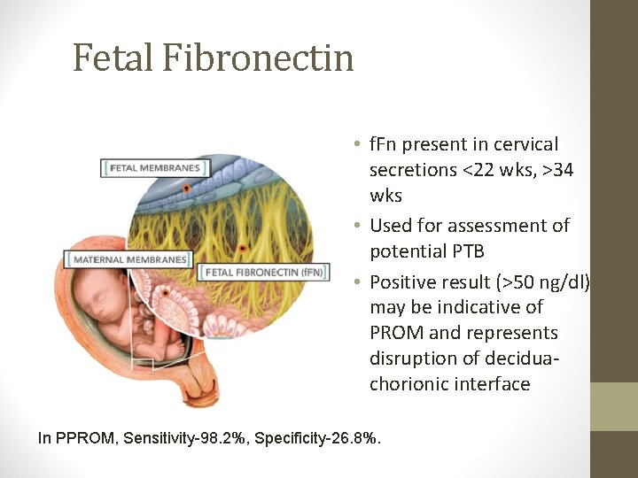 Fetal Fibronectin • f. Fn present in cervical secretions <22 wks, >34 wks •