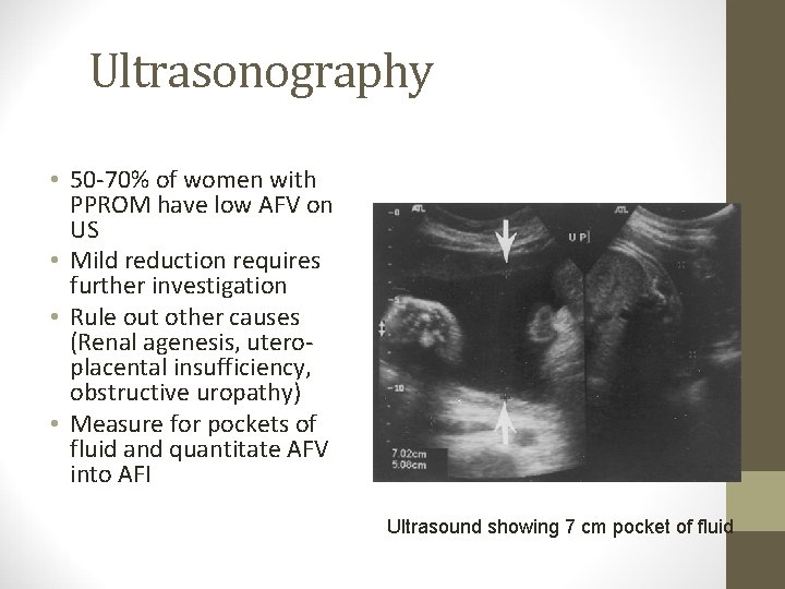 Ultrasonography • 50 -70% of women with PPROM have low AFV on US •