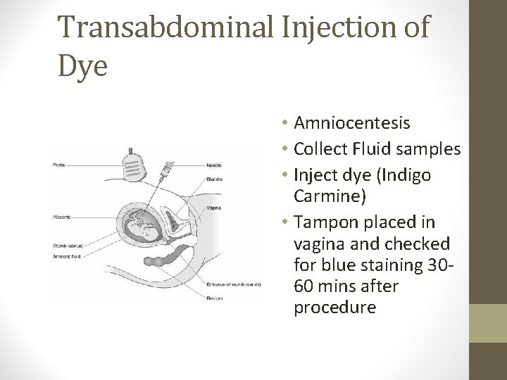 Transabdominal Injection of Dye • Amniocentesis • Collect Fluid samples • Inject dye (Indigo