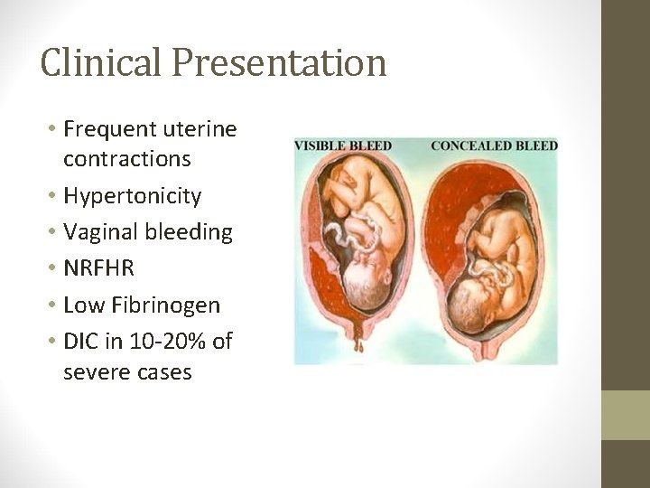 Clinical Presentation • Frequent uterine contractions • Hypertonicity • Vaginal bleeding • NRFHR •