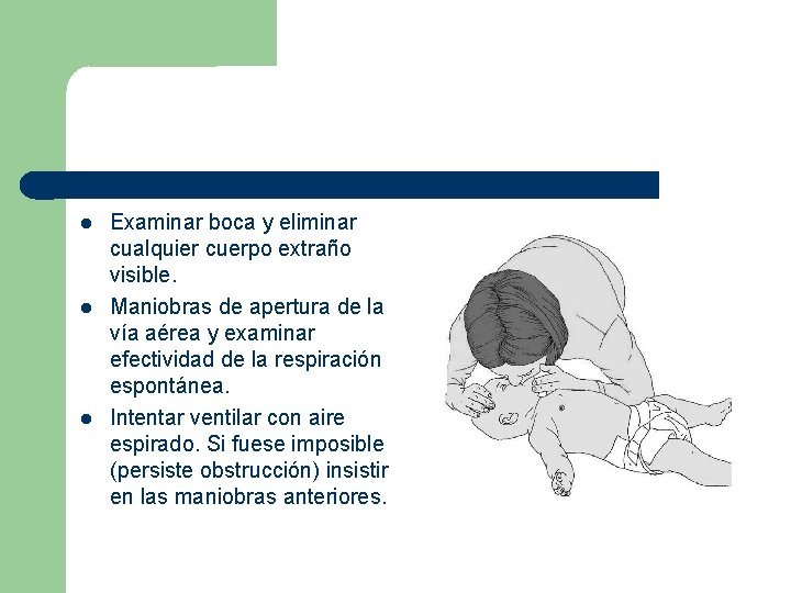  Examinar boca y eliminar cualquier cuerpo extraño visible. Maniobras de apertura de la