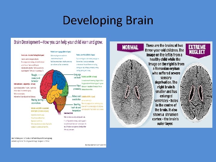 Developing Brain 