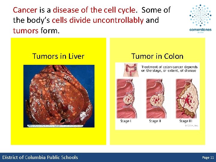 Cancer is a disease of the cell cycle. Some of the body’s cells divide