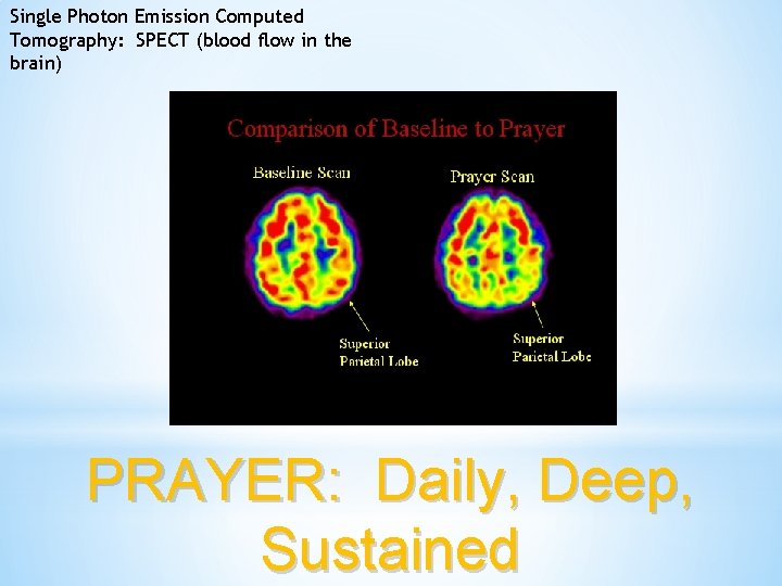 Single Photon Emission Computed Tomography: SPECT (blood flow in the brain) PRAYER: Daily, Deep,