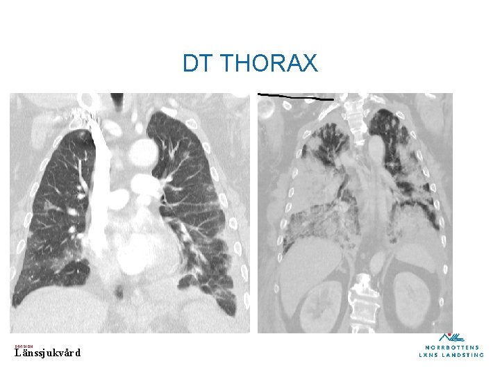 DT THORAX DIVISION Länssjukvård 