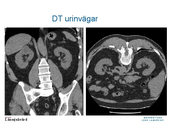 DT urinvägar DIVISION Länssjukvård 