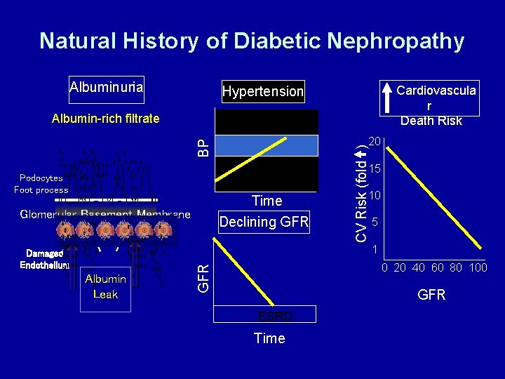 Natural History of Diabetic Nephropathy Albuminuria Cardiovascula r Death Risk Hypertension Albumin-rich filtrate CV
