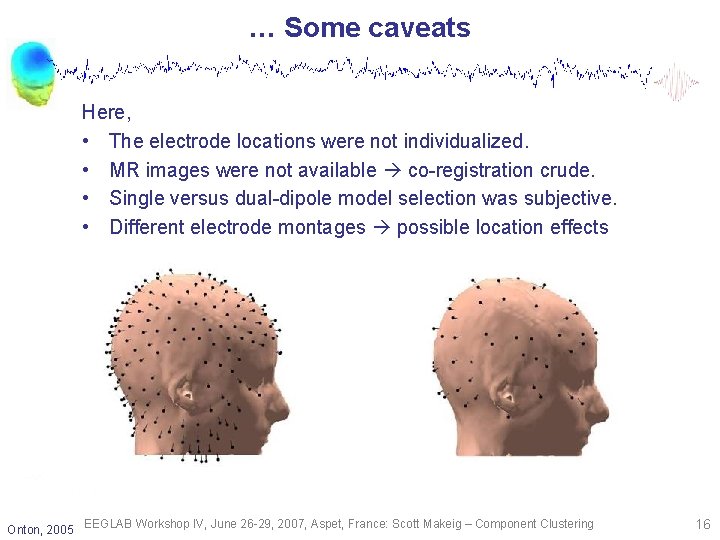 … Some caveats Here, • The electrode locations were not individualized. • MR images