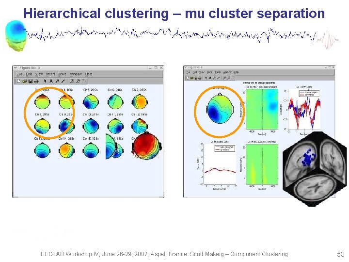 Hierarchical clustering – mu cluster separation EEGLAB Workshop IV, June 26 -29, 2007, Aspet,