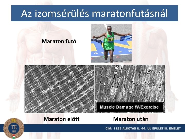 Az izomsérülés maratonfutásnál Maraton futó Maraton előtt Maraton után 