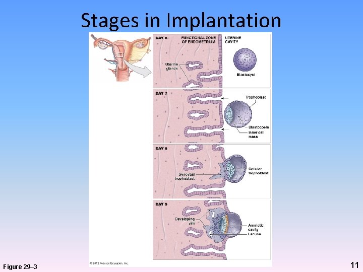 Stages in Implantation Figure 29– 3 11 