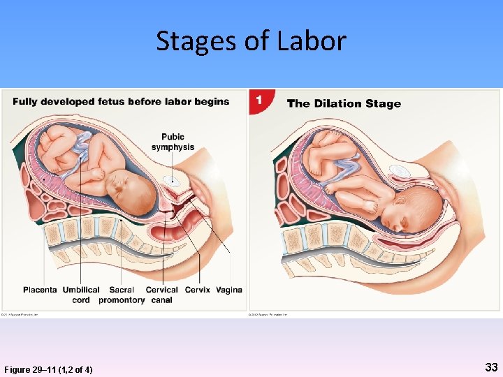 Stages of Labor Figure 29– 11 (1, 2 of 4) 33 