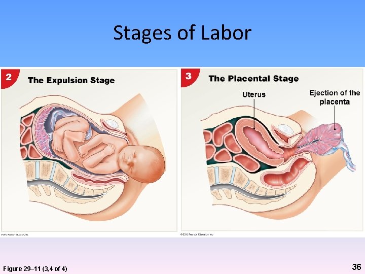 Stages of Labor Figure 29– 11 (3, 4 of 4) 36 