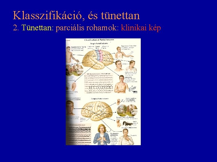 Klasszifikáció, és tünettan 2. Tünettan: parciális rohamok: klinikai kép Klasszifikáció, és tünettan 2. Tünettan: parciális rohamok: klinikai kép