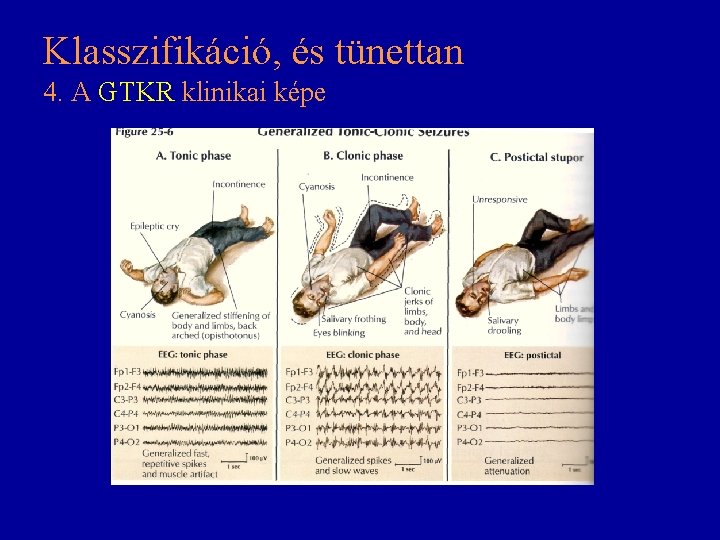 Klasszifikáció, és tünettan 4. A GTKR klinikai képe 