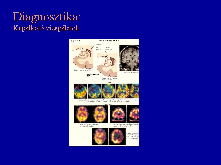 Diagnosztika: Képalkotó vizsgálatok Diagnosztika: Képalkotó vizsgálatok