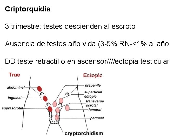 Criptorquidia 3 trimestre: testes descienden al escroto Ausencia de testes año vida (3 -5%