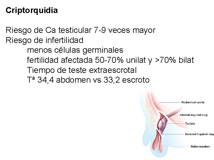 Criptorquidia Riesgo de Ca testicular 7 -9 veces mayor Riesgo de infertilidad menos células
