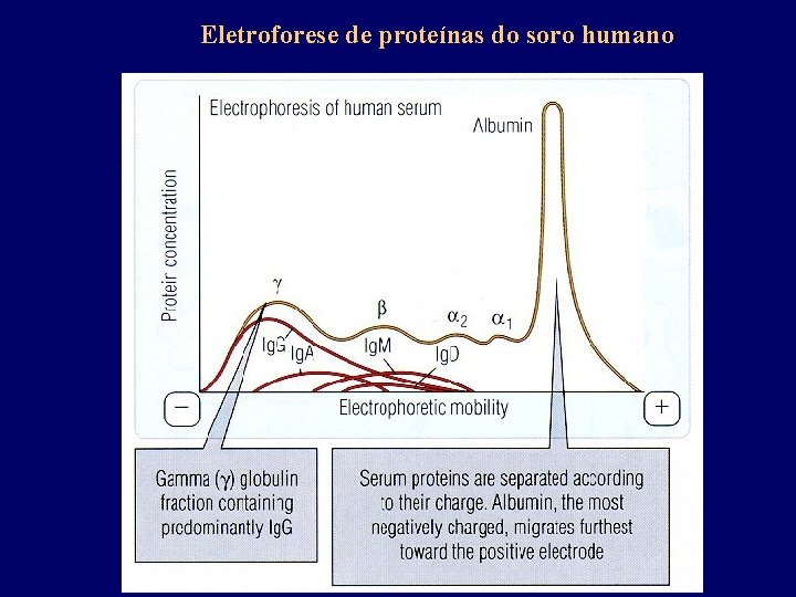 Eletroforese de proteínas do soro humano 