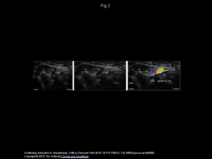 Fig 2 Continuing Education in Anaesthesia, Critical Care and Pain 2013 13174 -178 DOI: