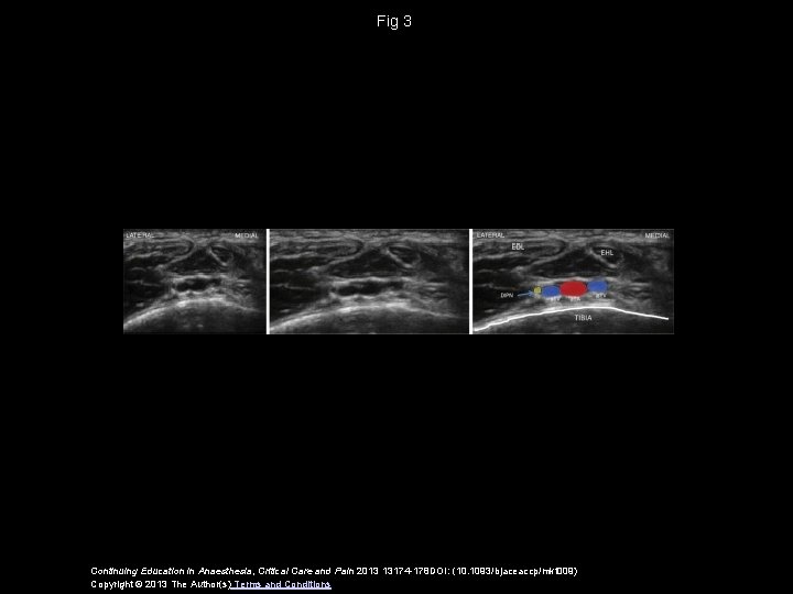 Fig 3 Continuing Education in Anaesthesia, Critical Care and Pain 2013 13174 -178 DOI: